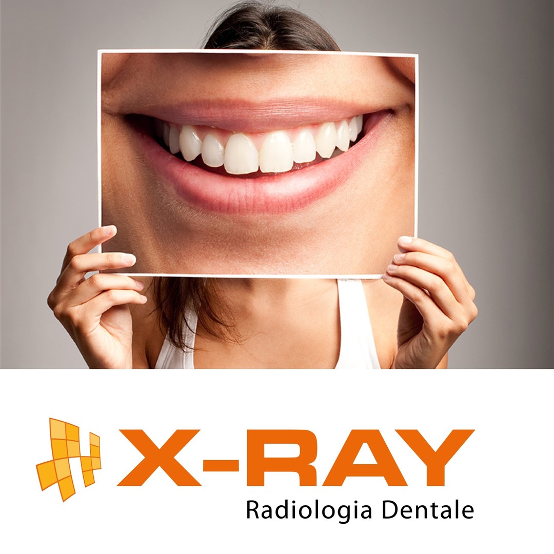 X-Ray Radiologia Dentale Roma